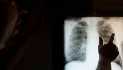 En büyük üçüncü ölüm nedeni: 652 milyon kişi mücadele veriyor