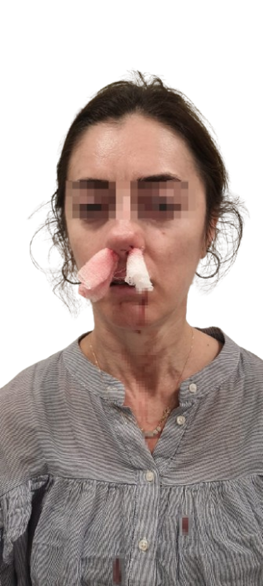 Kocasının sevgilisine benzetip dayak attı: "Pardon" deyip kaçtı 2