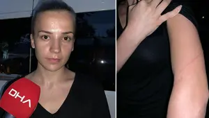 Kediyi ezen şoför, kendisine tepki gösteren kadını darp etti