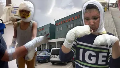 Mazot dolu tenekeyle oynayan 4 çocuk ağır yaralandı