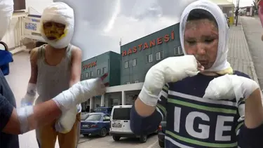 Mazot dolu tenekeyle oynayan 4 çocuk ağır yaralandı