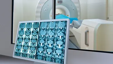 Kanser taraması ile 79 bin erken teşhis