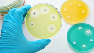 Bilim insanlarından antibiyotik uyarısı: Her gün 3 bin 500 kişi ölüyor