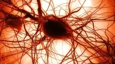 MS'e kök hücre tedavisi