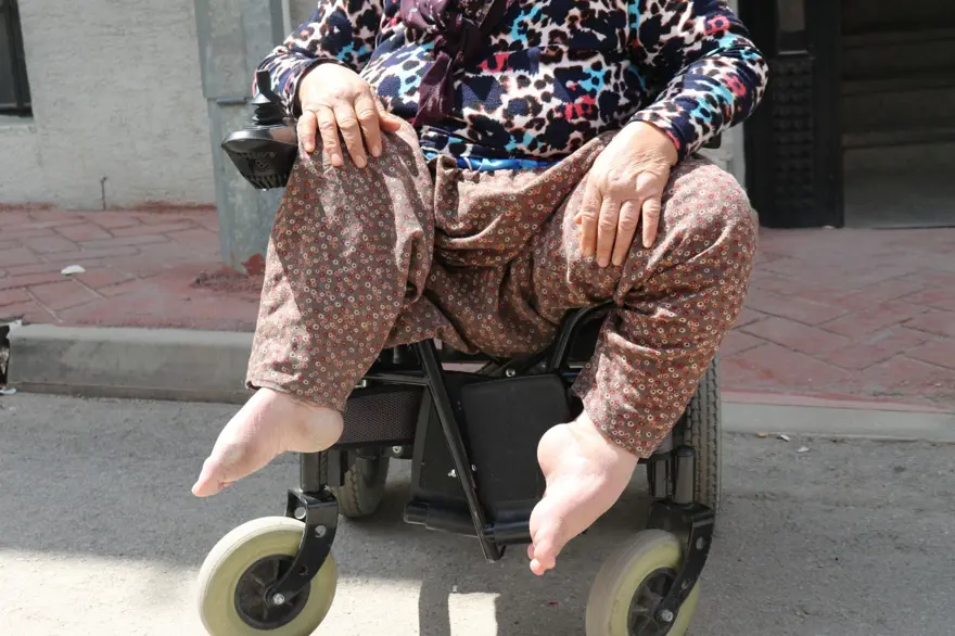 63 yıldır sürünen Hatice teyzenin yürek yakan dramı: Aylık 6 bin TL ile geçiniyor 2