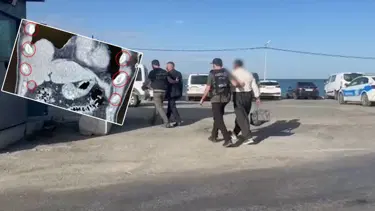 Yolcu otobüsündeki iki şüphelinin midesinden 136 kapsül uyuşturucu çıktı