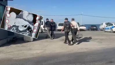 Yolcu otobüsündeki iki şüphelinin midesinden 136 kapsül uyuşturucu çıktı