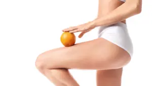 Selülit neden olur, nasıl geçer?