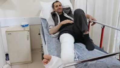Üzerine kurbanlık düştü, ayağı kırıldı
