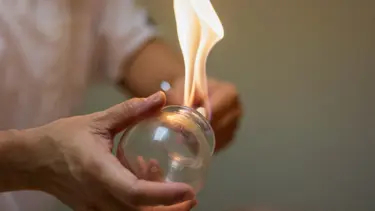 Hacamat nasıl yapılır? Hacamat ne zaman yapılmalıdır? Kimler yaptırabilir?