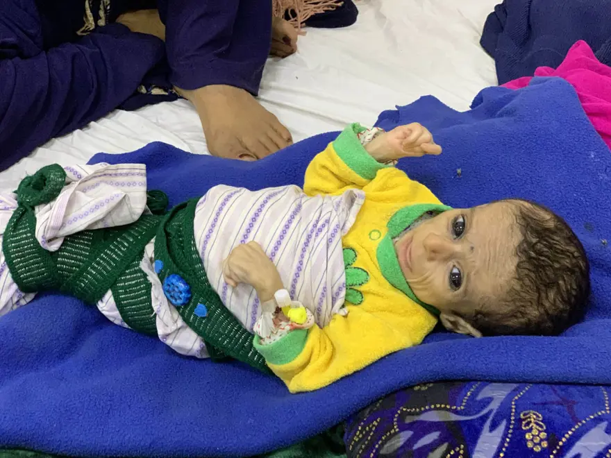 İnsanlık dramı: Sütten kesilen Afgan annelerin bebekleri büyüyemiyor 6 İnsanlık dramı: Sütten kesilen Afgan annelerin bebekleri büyüyemiyor 6