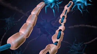 MS çocukları da tehdit ediyor!