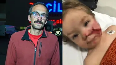 Başkentte pitbull dehşeti. İki kardeş yaralandı, birinin yüzü parçalandı