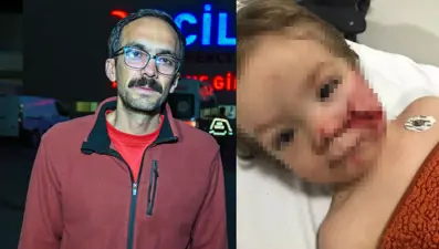 Başkentte pitbull dehşeti. İki kardeş yaralandı, birinin yüzü parçalandı