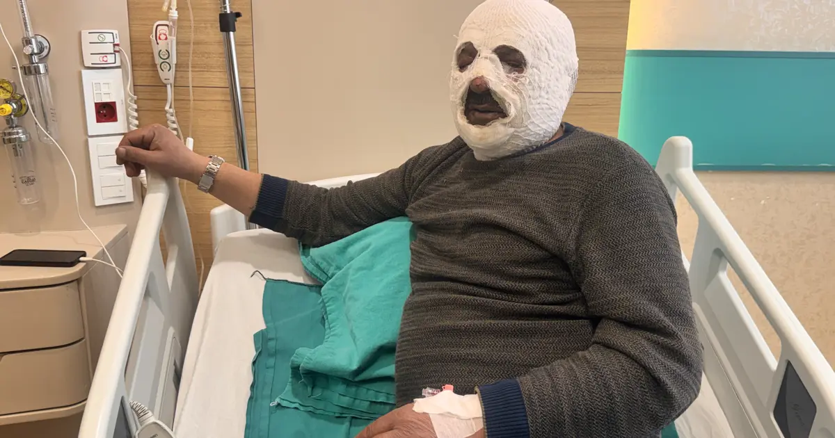 Sular dondu, ateşi hızlandırmak istedi: "Ben yandım kimse yanmasın"