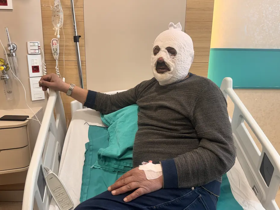 Sular dondu, ateşi hızlandırmak istedi: “Ben yandım kimse yanmasın”