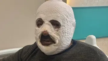 Sular dondu, ateşi hızlandırmak istedi: "Ben yandım kimse yanmasın"
