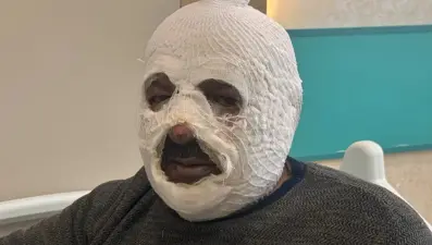 Sular dondu, ateşi hızlandırmak istedi: "Ben yandım kimse yanmasın"
