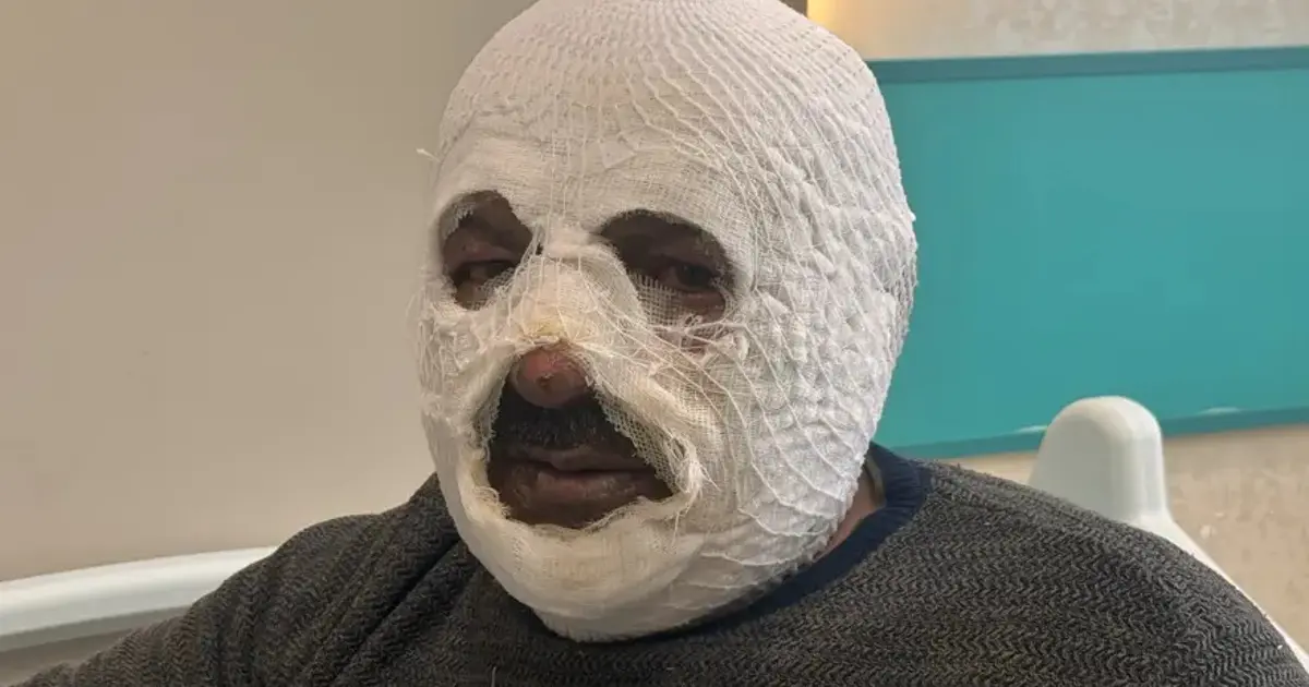 Sular dondu, ateşi hızlandırmak istedi: "Ben yandım kimse yanmasın"