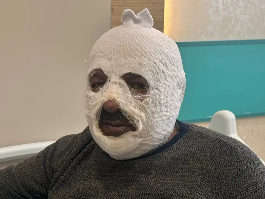 Sular dondu, ateşi hızlandırmak istedi: 