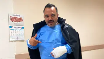 Soğuk havayı test etmek isterken kendini yaktı