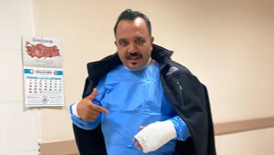 Soğuk havayı test etmek isterken kendini yaktı