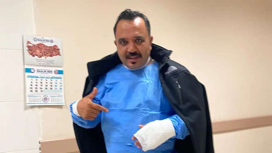 Soğuk havayı test etmek isterken kendini yaktı