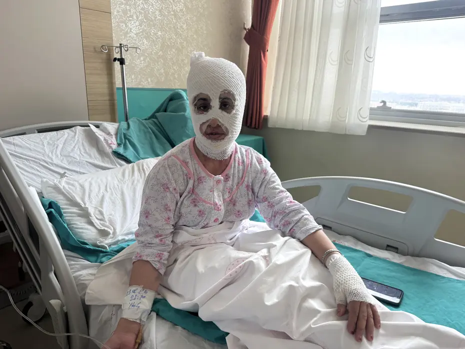 İftar hazırlığında düdüklü patladı, iki çocuk annesi hastanelik oldu