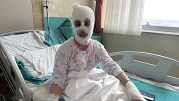 İftar hazırlığında düdüklü patladı, iki çocuk annesi hastanelik oldu