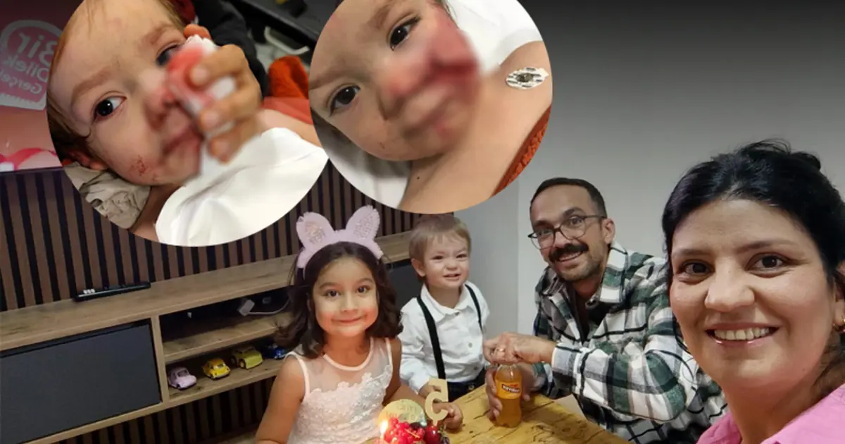 Ankara'daki pitbull dehşetinin perde arkası. 1,5 ve 5 yaşındaki iki çocuğu yaraladı, sahibi yakalandı