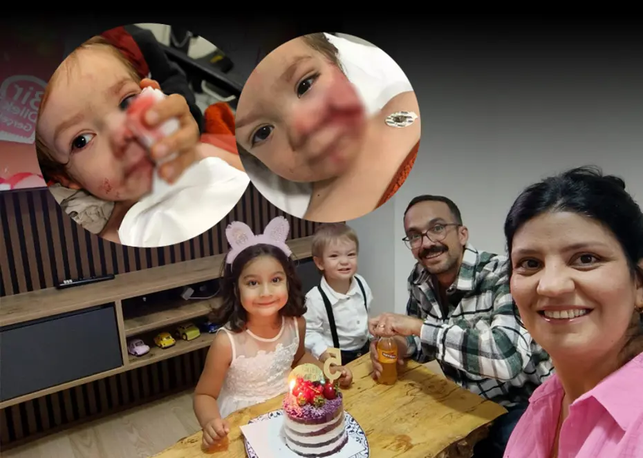 Ankara'daki pitbull dehşetinin perde arkası. 1,5 ve 5 yaşındaki iki çocuğu yaraladı, sahibi yakalandı