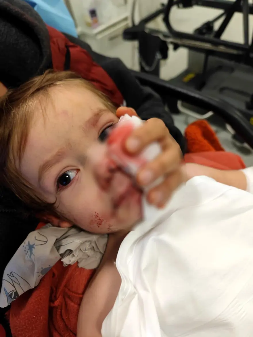 Pitbull saldırısına uğrayan minik Efe'den haber var 1