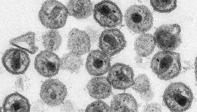 Dünyada 40 milyon 800 bin kişi HIV virüsü taşıyor