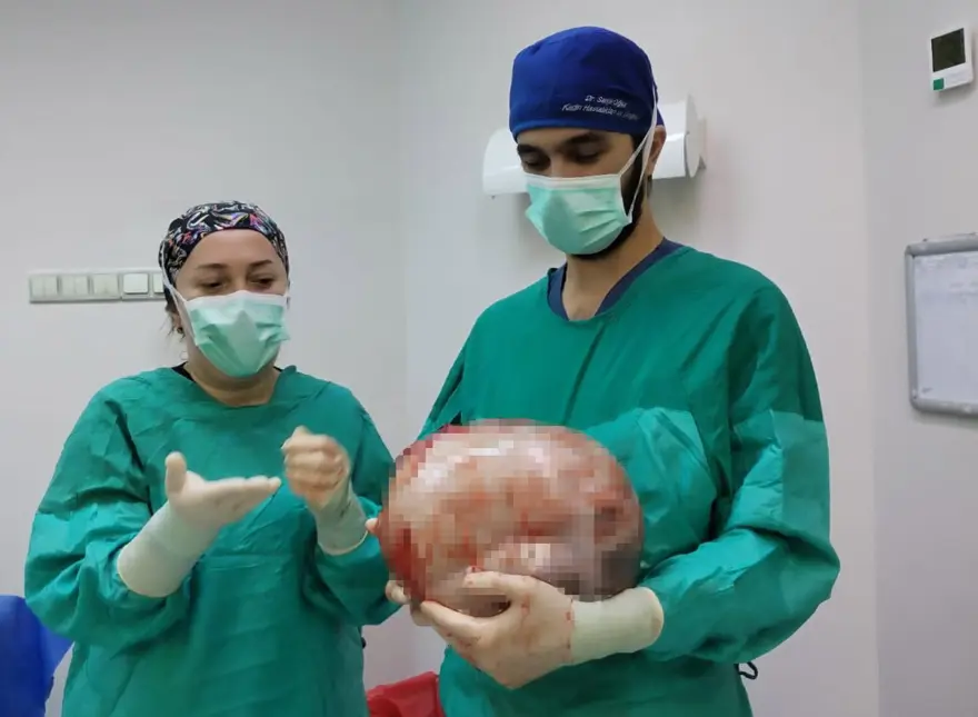 "6 AY YA DA 1 YILDA GENEL KONTROL YAPILMALI" 3