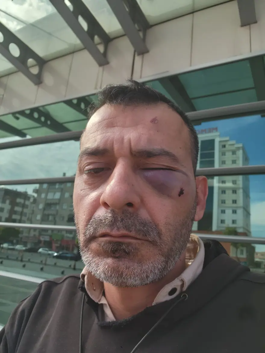 Kayseri'nin "Geppetto Ustası"na dayak  2