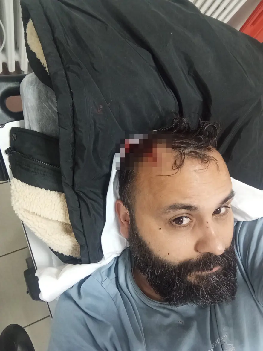 Kayseri'nin "Geppetto Ustası"na dayak  1