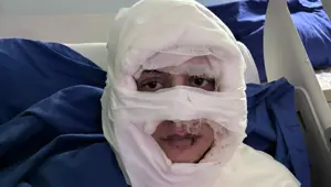 Genç kadının yüzüne kolonya döküp ateşe verdi: Şüpheli kadın tutuklandı