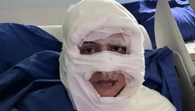 Genç kadının yüzüne yanıcı madde döküp ateşe verdi: Şüpheli kadın tutuklandı