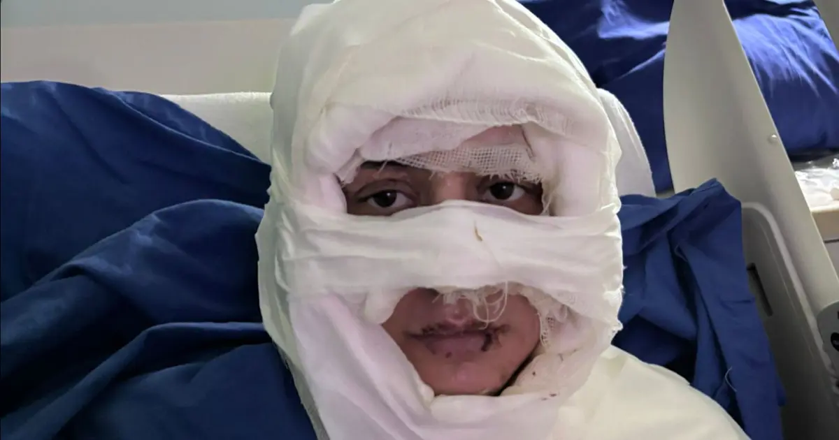 Genç kadının yüzüne yanıcı madde döküp ateşe verdi: Şüpheli kadın tutuklandı