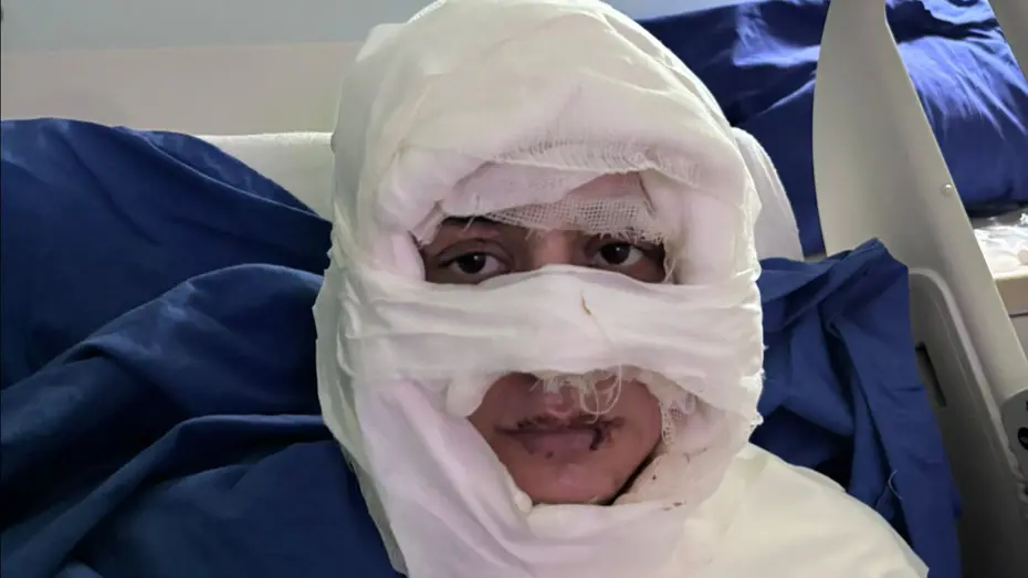 Genç kadının yüzüne yanıcı madde döküp ateşe verdi: Şüpheli kadın tutuklandı