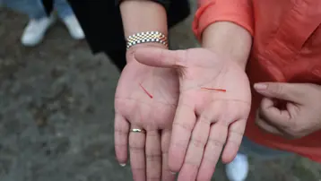 Meme kanseri tedavisinde etkili olduğu biliniyor, gramı 600 lira