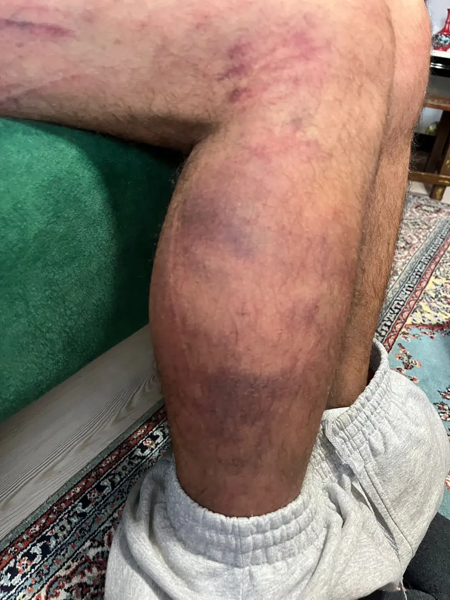 "EN AĞIR ŞEKİLDE YARGILANMASINI İSTİYORUZ" 4