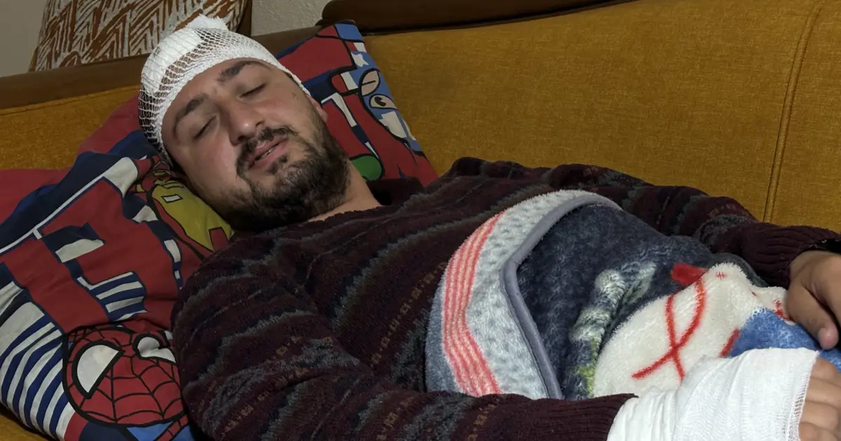 Otizmli bir kişiyi "odunluğa baktı" diye dövdüler