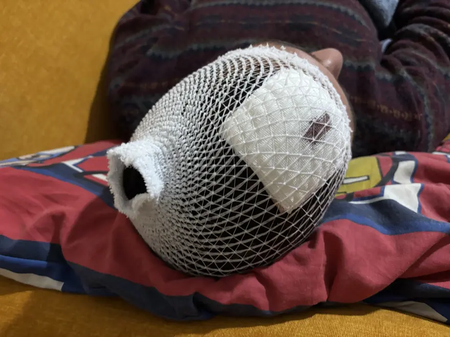 Otizmli bir kişiyi "odunluğa baktı" diye dövdüler 3