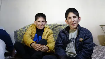 15 milyonda bir görülen kromozom 4q delesyon sendromuyla dünyaya gelen ikiz kardeşler 13 yıldır hastalıkla mücadele ediyor