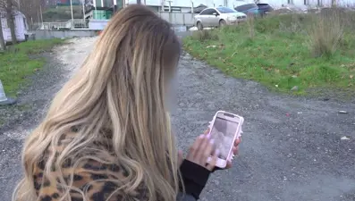 180 bin lira ödedi, vücudu paramparça oldu. Daha güzel olmak istedi ama hayatı karardı