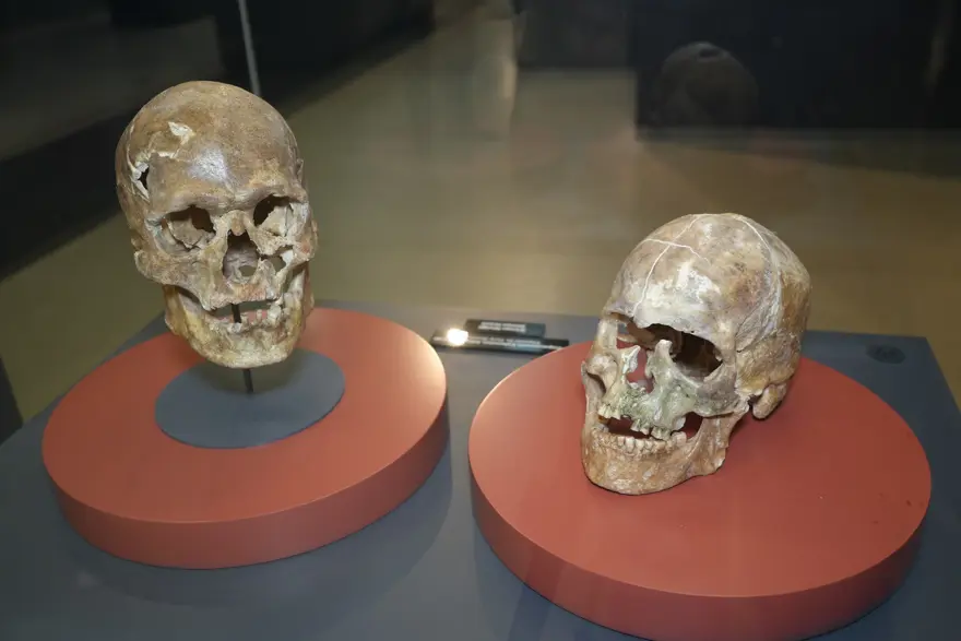 İnsanlık tarihinde bir ilk. 5 bin yıllık kafatası hikayesiyle ilgi çekiyor İnsanlık tarihinde bir ilk. 5 bin yıllık kafatası hikayesiyle ilgi çekiyor