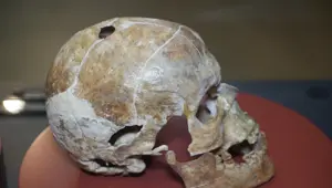 İnsanlık tarihinde bir ilk. 5 bin yıllık kafatası hikayesiyle ilgi çekiyor