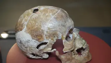 İnsanlık tarihinde bir ilk. 5 bin yıllık kafatası hikayesiyle ilgi çekiyor