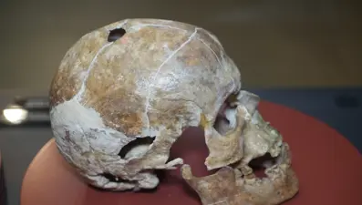 İnsanlık tarihinde bir ilk. 5 bin yıllık kafatası hikayesiyle ilgi çekiyor